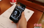手机扫描二维码得到的医疗影像。　周燕玲 摄 - 贵州新闻