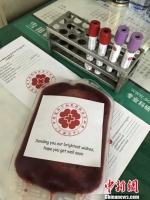 中华骨髓库向国(境)外捐献第300例造血干细胞 - 贵州新闻